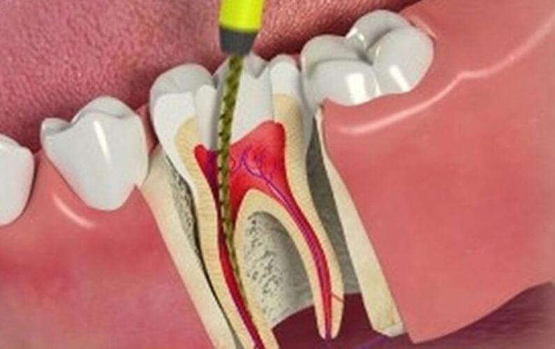 Kalathil Dental Clinic & Dental X -Ray Centre Mannarkkad