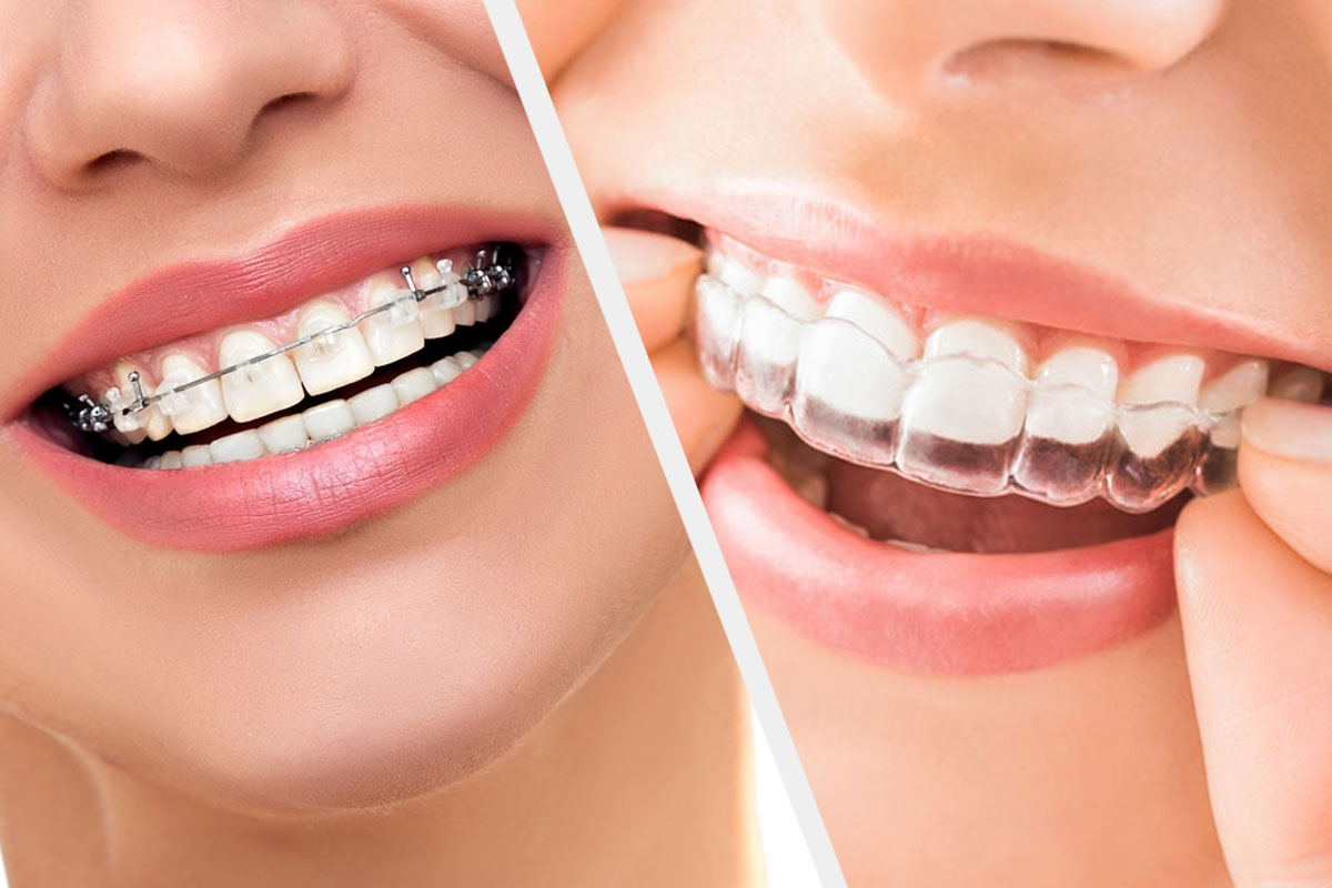 Kalathil Dental Clinic & Dental X -Ray Centre Mannarkkad